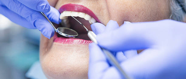 Best Emergency Treatment for Toothache in Ouray, CO